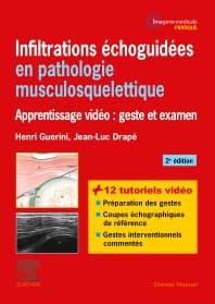 Infiltrations échoguidées en pathologie musculosquelettique