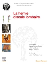 La hernie discale lombaire