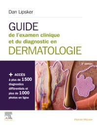 Guide de l'examen clinique et du diagnostic en dermatologie