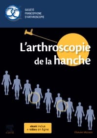 L'arthroscopie de la hanche