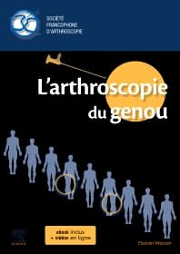 L'arthroscopie du genou