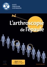 L'arthroscopie de l'épaule