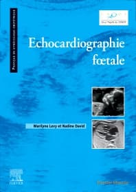 Echocardiographie fœtale