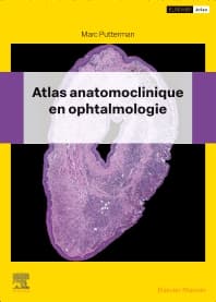 Atlas anatomoclinique en ophtalmologie