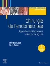 Chirurgie de l'endométriose