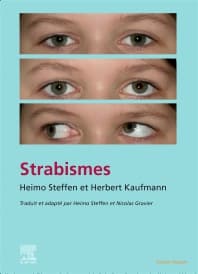 Strabisme