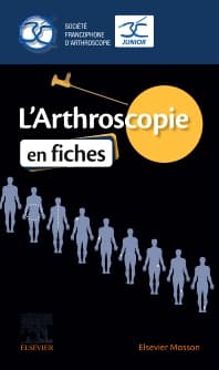 L'Arthroscopie en fiches