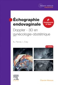 Échographie endovaginale Doppler - 3D