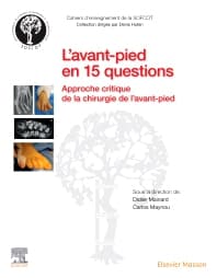 L'avant-pied en 15 questions