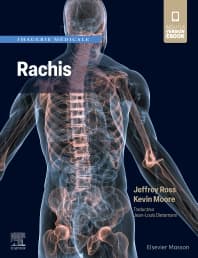 Imagerie médicale : Rachis