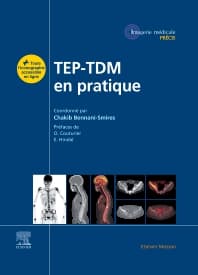 TEP-TDM en pratique