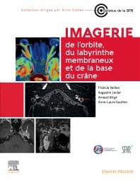 Imagerie de l'orbite, du labyrinthe membraneux et de la base du crâne