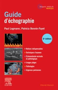 Guide pratique d'échographie