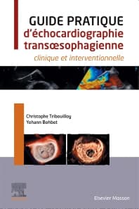 Guide pratique d'échocardiographie transœsophagienne