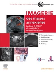 Imagerie des masses annexielles