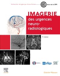 Imagerie des urgences neuroradiologiques