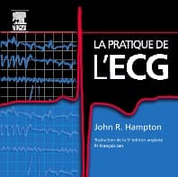 La pratique de l'ECG