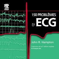 150 problèmes d'ECG