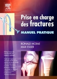 Prise en charge des fractures