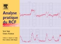 Analyse pratique du RCF