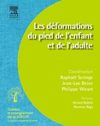 Les déformations du pied de l’enfant et de l’adulte