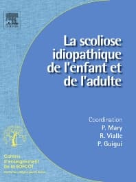 La scoliose idiopathique de l'enfant et de l'adulte