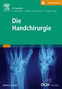 Die Handchirurgie