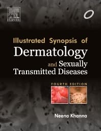 Illustrated Synopsis of Dermatology & Sexually Transmitted Diseases