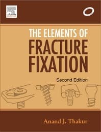 Elements of Fracture Fixation