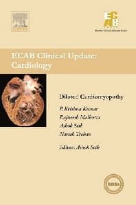 Dilated Cardiomyopathy - ECAB