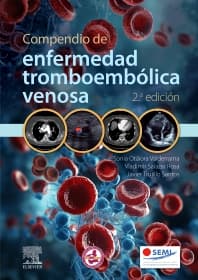 Compendio de enfermedad tromboembólica venosa