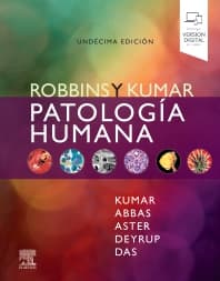 Robbins y Kumar. Patología humana