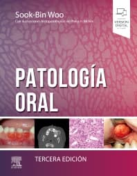 Patología oral