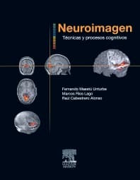 Neuroimagen. Técnicas y procesos cognitivos