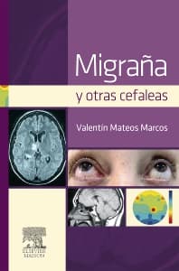 Migraña y otras cefaleas