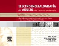 Electroencefalografía del adulto