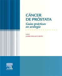 Cáncer de próstata