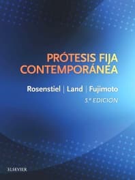 Prótesis fija contemporánea