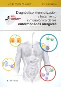 Diagnóstico, monitorización y tratamiento inmunológico de las enfermedades alérgicas