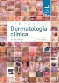 Ferrándiz. Dermatología clínica