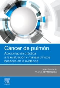 Cáncer de pulmón