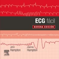 ECG fácil