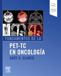 Fundamentos de la PET-TC en oncología