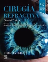 Cirugía refractiva