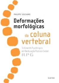 Deformações Morfológicas da Coluna Vertebral