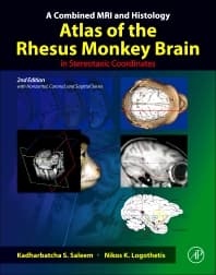 Image - A Combined MRI and Histology Atlas of the Rhesus Monkey Brain in Stereotaxic Coordinates