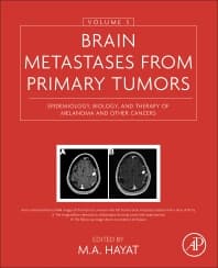 Image - Brain Metastases from Primary Tumors, Volume 3