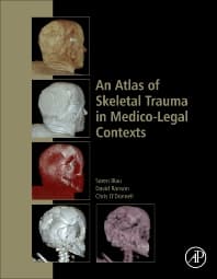 Image - An Atlas of Skeletal Trauma in Medico-Legal Contexts
