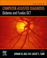 Image - Diabetes and Fundus OCT