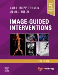 Image - Image-Guided Interventions